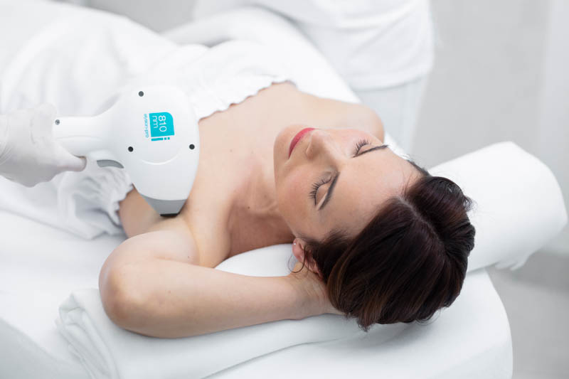 Elysion Pro-val végzett lézeres szőrtelenítő kezelés a SkinLaser szalonjában