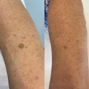 2CE6C516-36FA-45CB-878A-9B7FBB504AD1