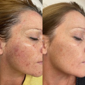 E2996987-B285-40DF-933D-F2BEB23BEC2D